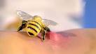 Сколько укусов пчёл может стать смертельным для...