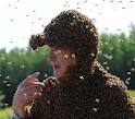 Как лечить отек после укуса пчел или слепней? 